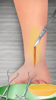 WristSurgeryDoctor скриншот 10