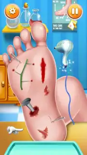 Foot Surgery Doctor Care скриншот 10